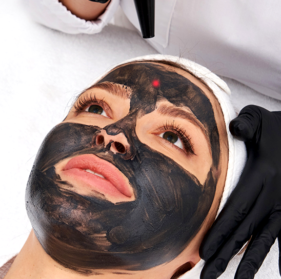 Hollywood Carbon Peel