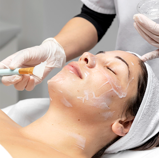 Chemical Peel